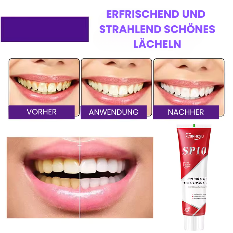 Zahnpasta speziell für Zahnaufhellung